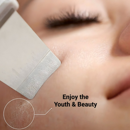 Velora Ultrasonic Skin Scrubber