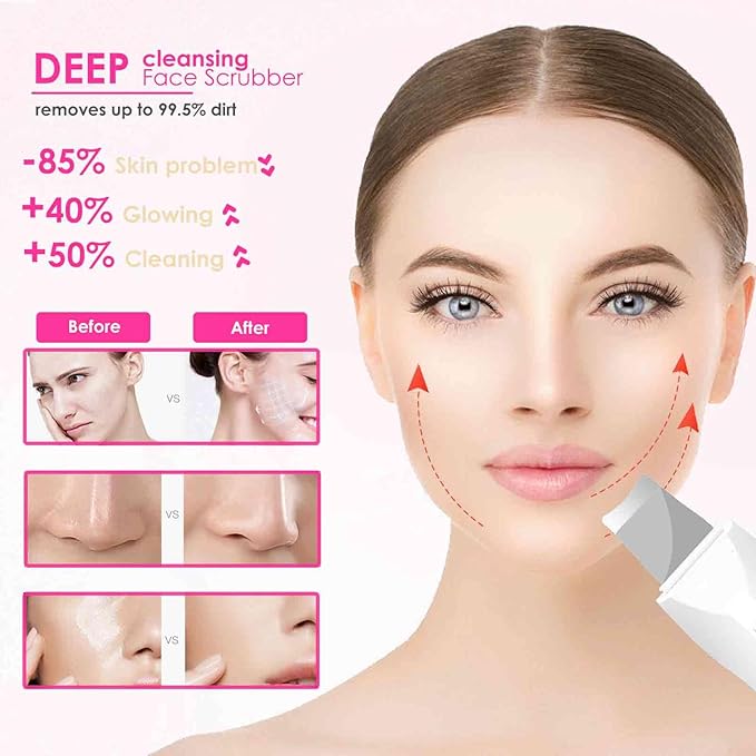 Velora Ultrasonic Skin Scrubber