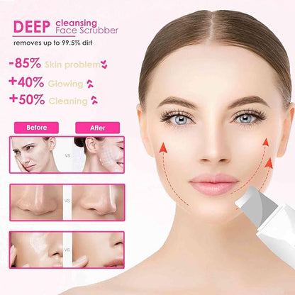 Velora Ultrasonic Skin Scrubber